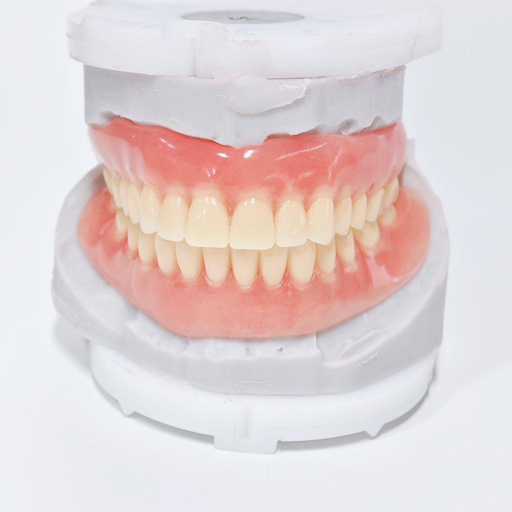 Full-Mouth Acrylic Denture