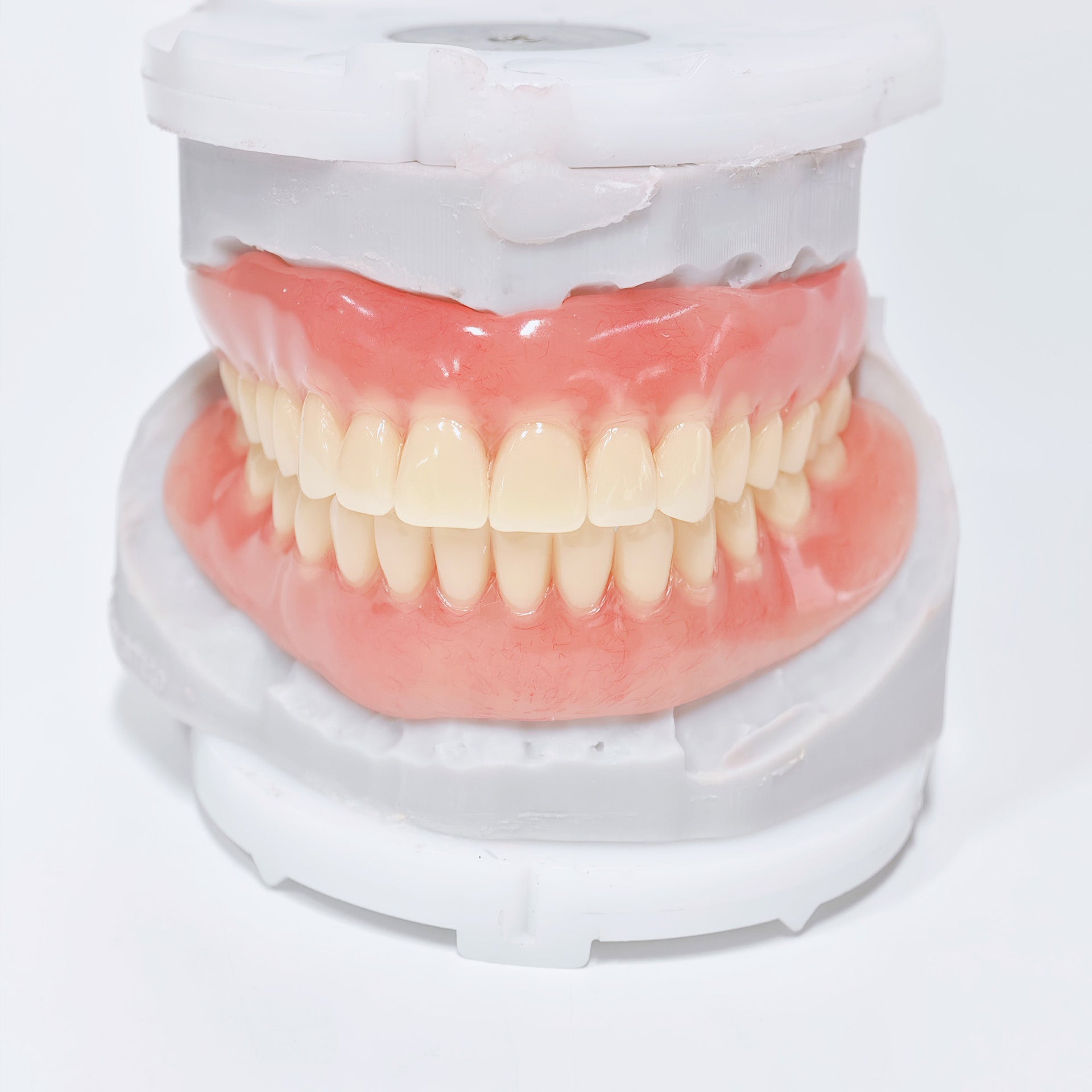 Full-Mouth Acrylic Denture
