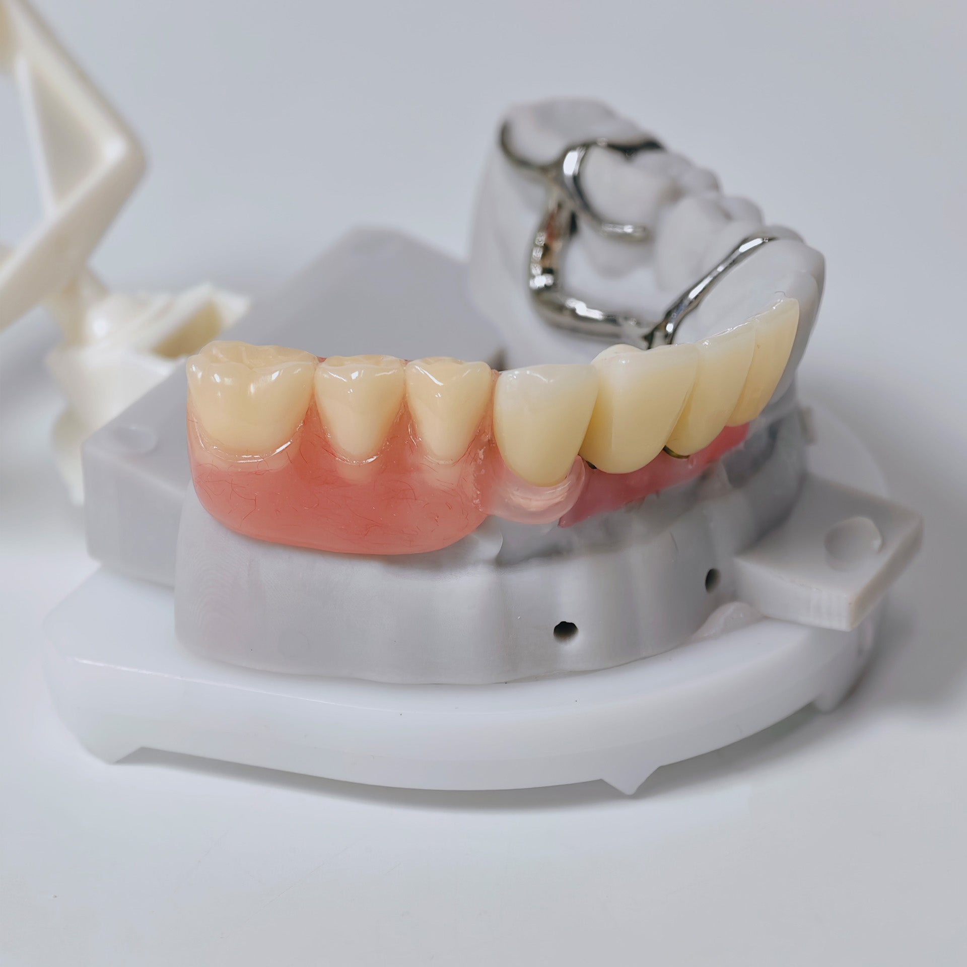 Full-Zirconia Crown And Bridge With Cement Retained And Co-Cr Frame Partial Denture
