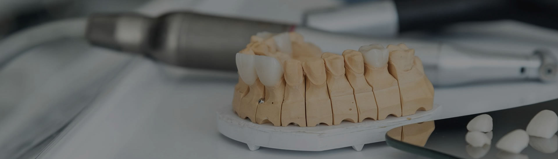 Zirconia bridge with cement re