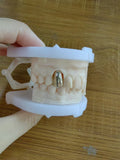 Full Metal Crown Non-Precious Gold Metal Dental Lab In China