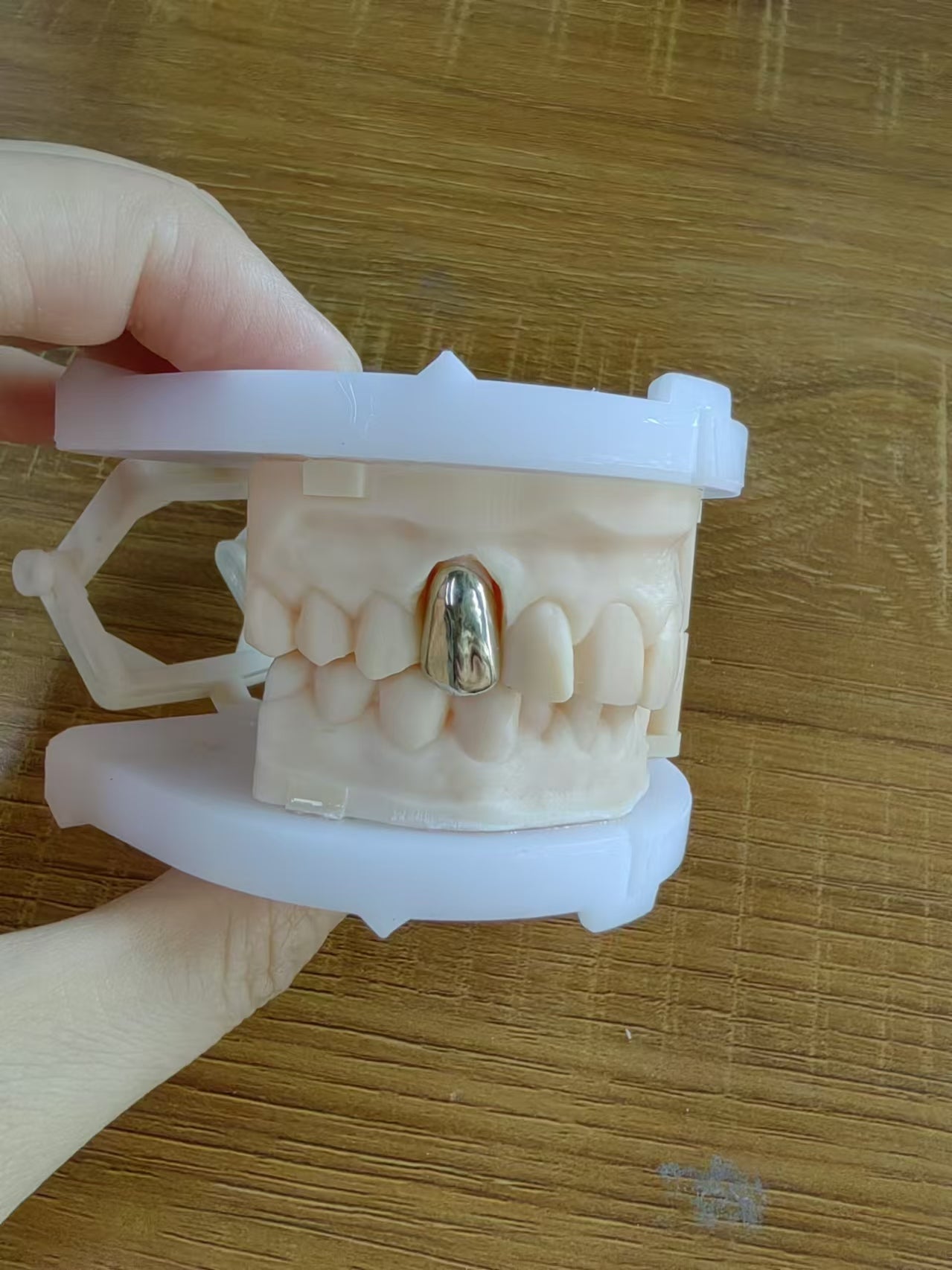 Full Metal Crown Non-Precious Gold Metal Dental Lab In China