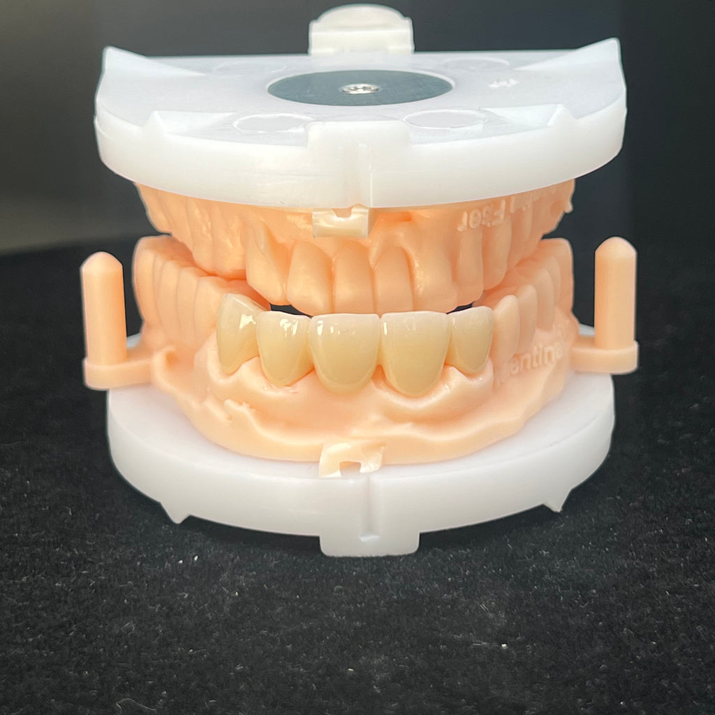 Multilayer Zirconia Bridges Aesthetic And Natural Restoration