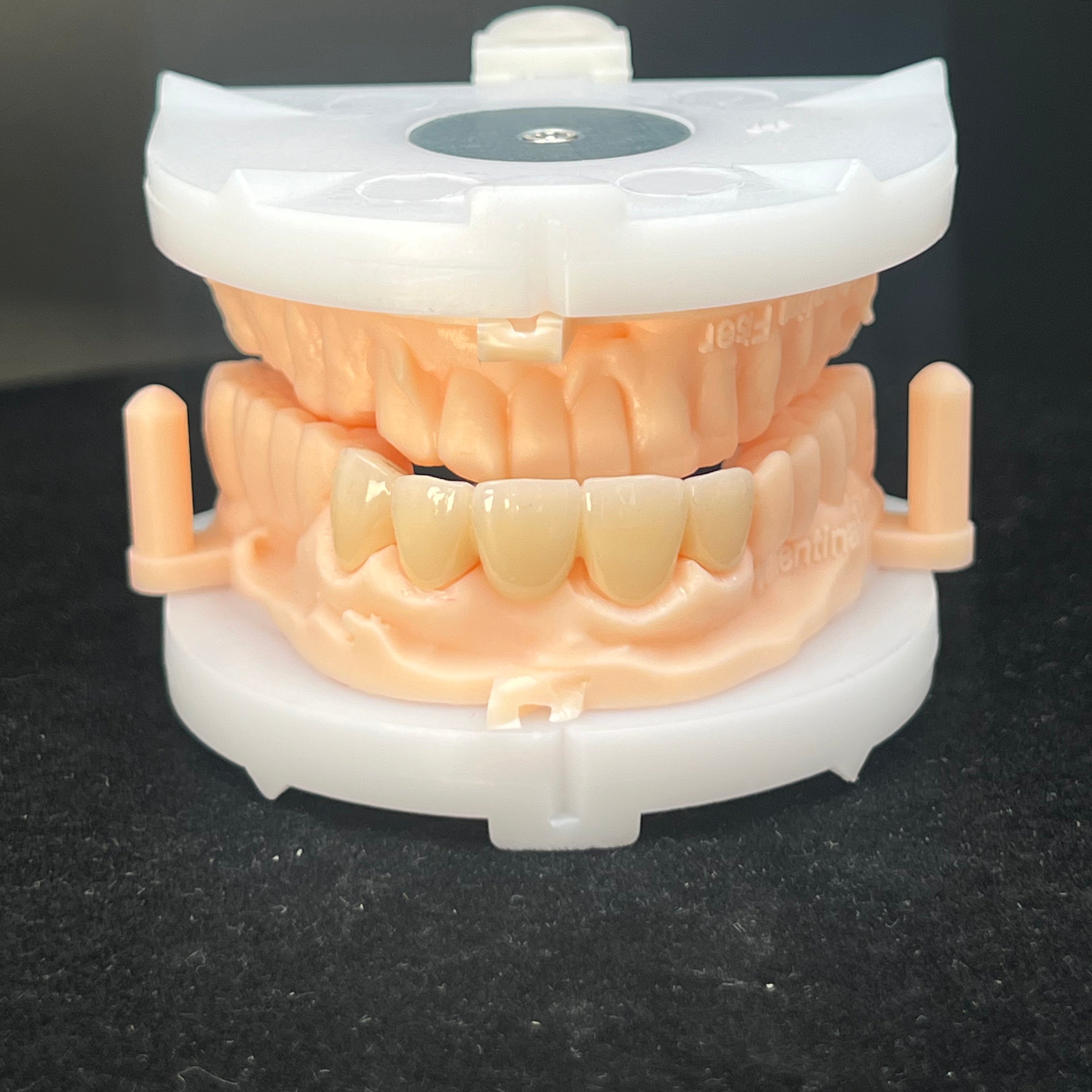 Multilayer Zirconia Bridges Aesthetic And Natural Restoration