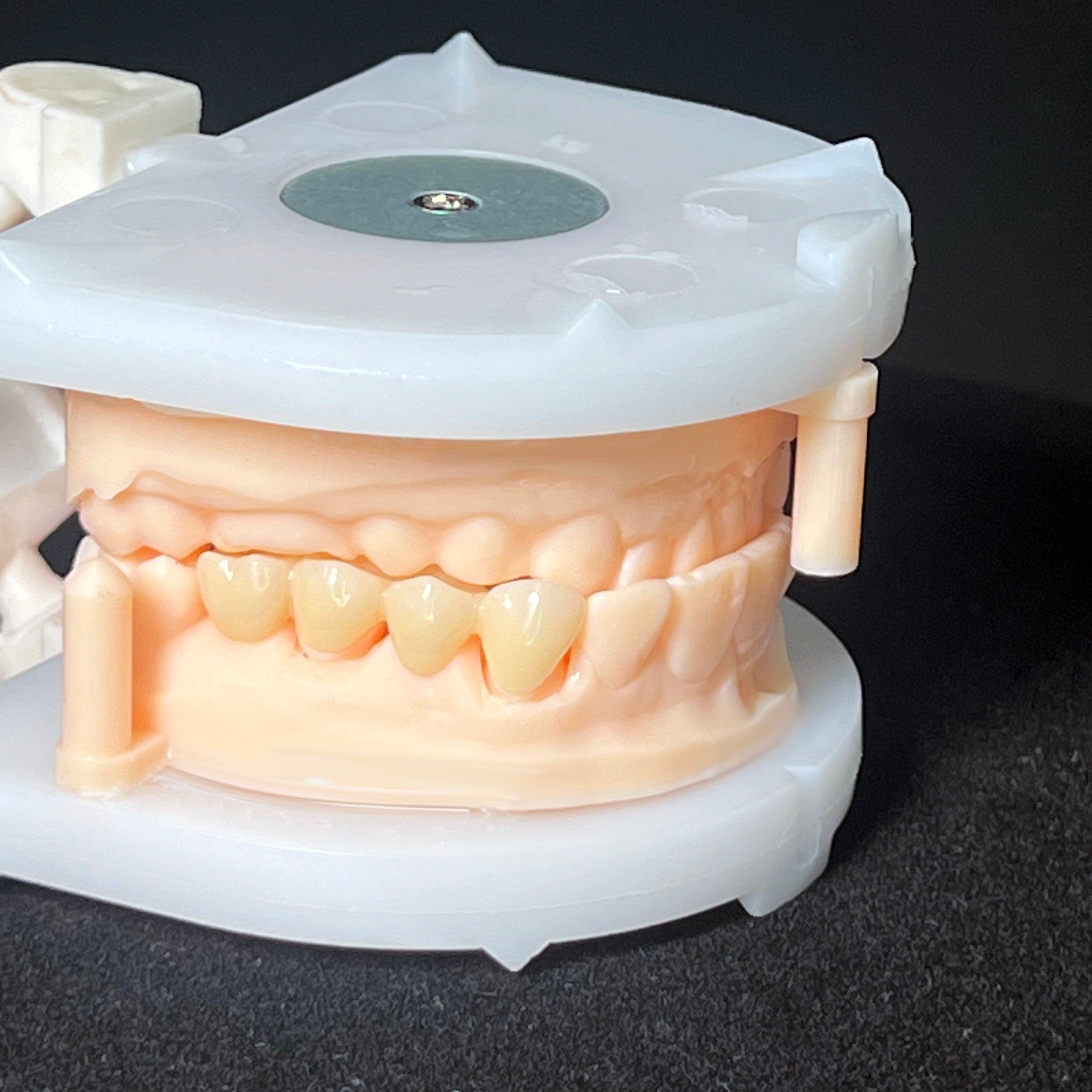 Multilayer Zirconia Crowns & Bridges