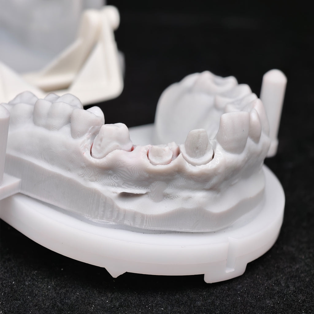 Co - Cr PFM Dental Bridge With Metal Post-And-Core
