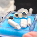 Co - Cr PFM Dental Bridge With Metal Post-And-Core