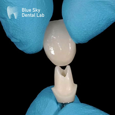 Zirconia abutment