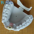 Zirconia Implant Crown Screw Retained Zirconia Dental Crown
