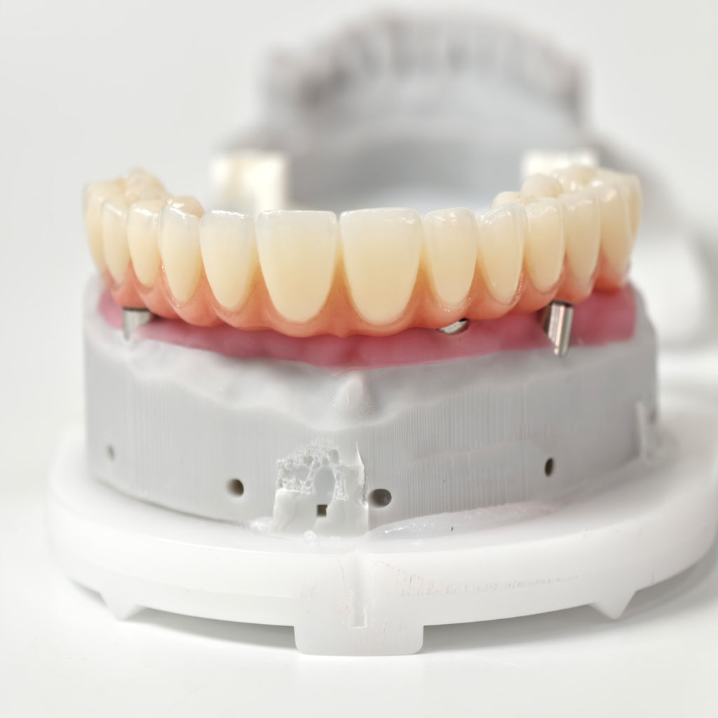 All On 5 Zirconia Bridge With Ti-Base Screw Retained