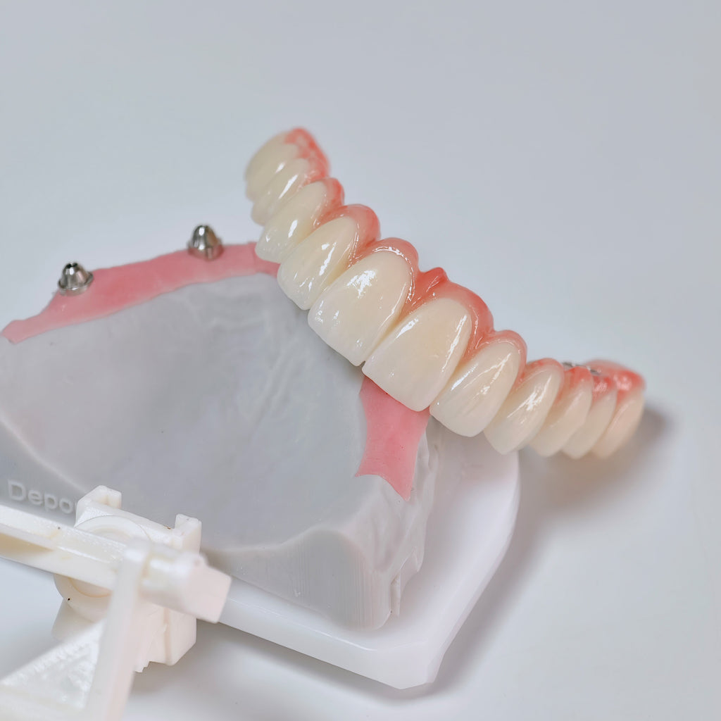All On 6 Zirconia Bridge With Ti-Base Screw Retained