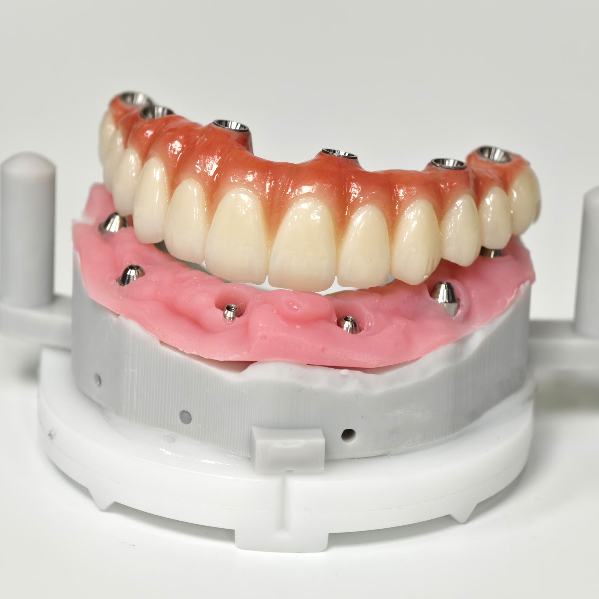 All On 6 Zirconia Bridge With Ti-Base Screw Retained