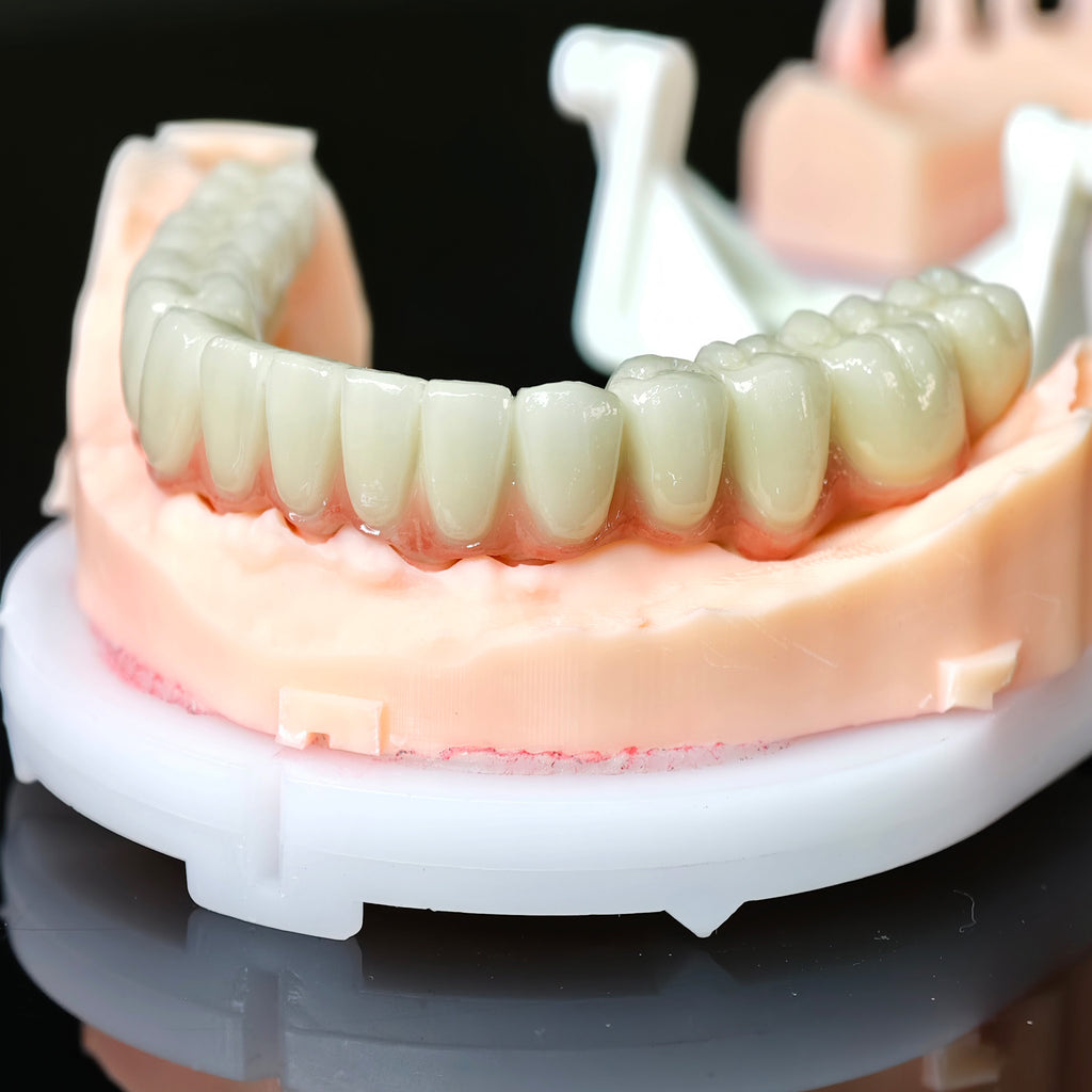 Co - Cr PFM Dental Bridge