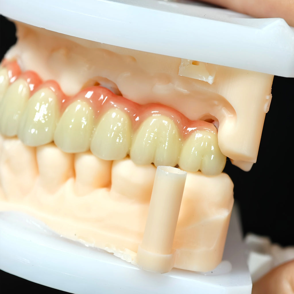 Co - Cr PFM Dental Bridge