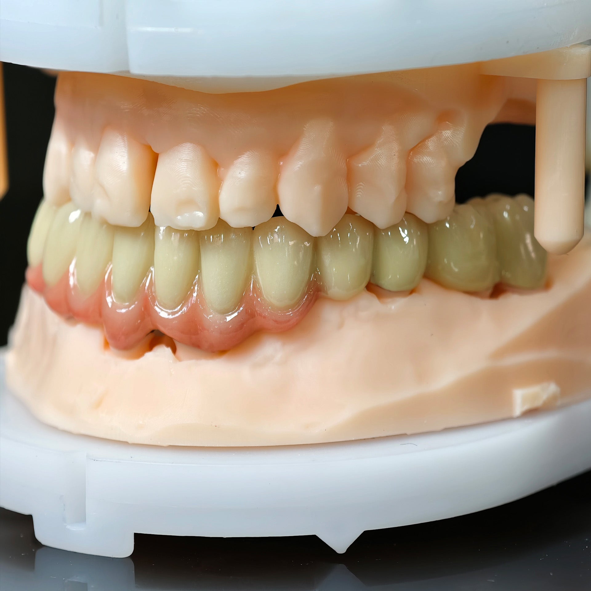 Co - Cr PFM Dental Bridge