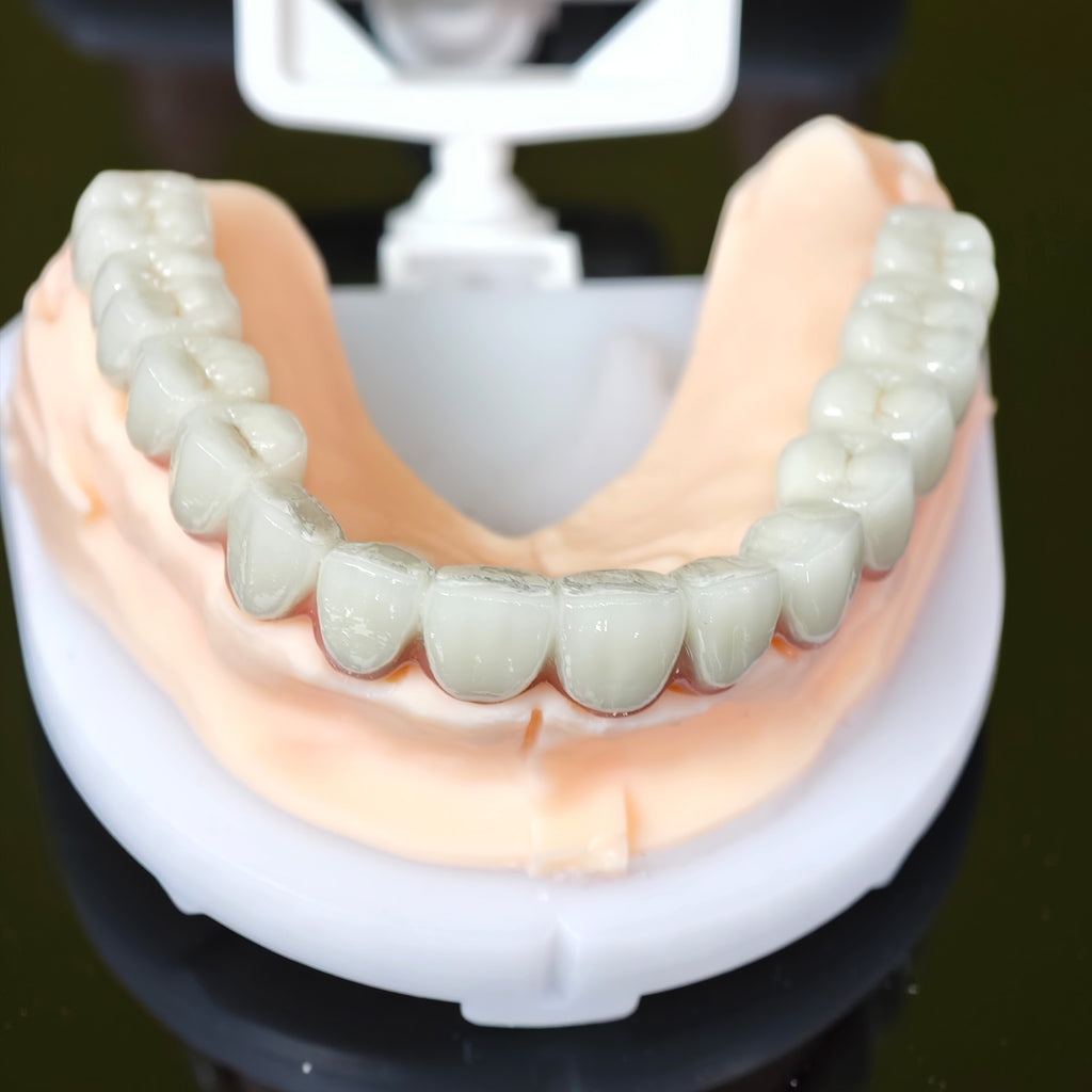 Co - Cr PFM Dental Bridge