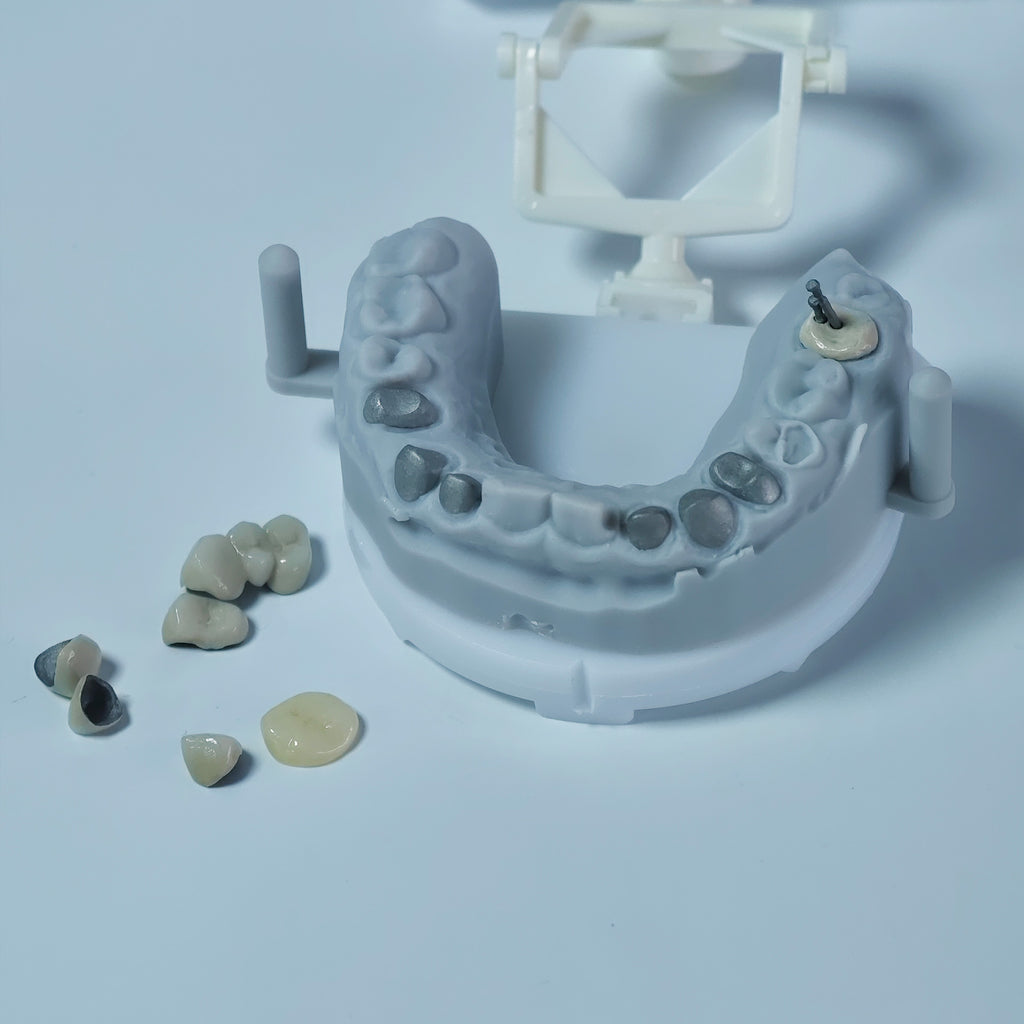 Co - Cr PFM Dental Crowns With Metal Post-And-Core