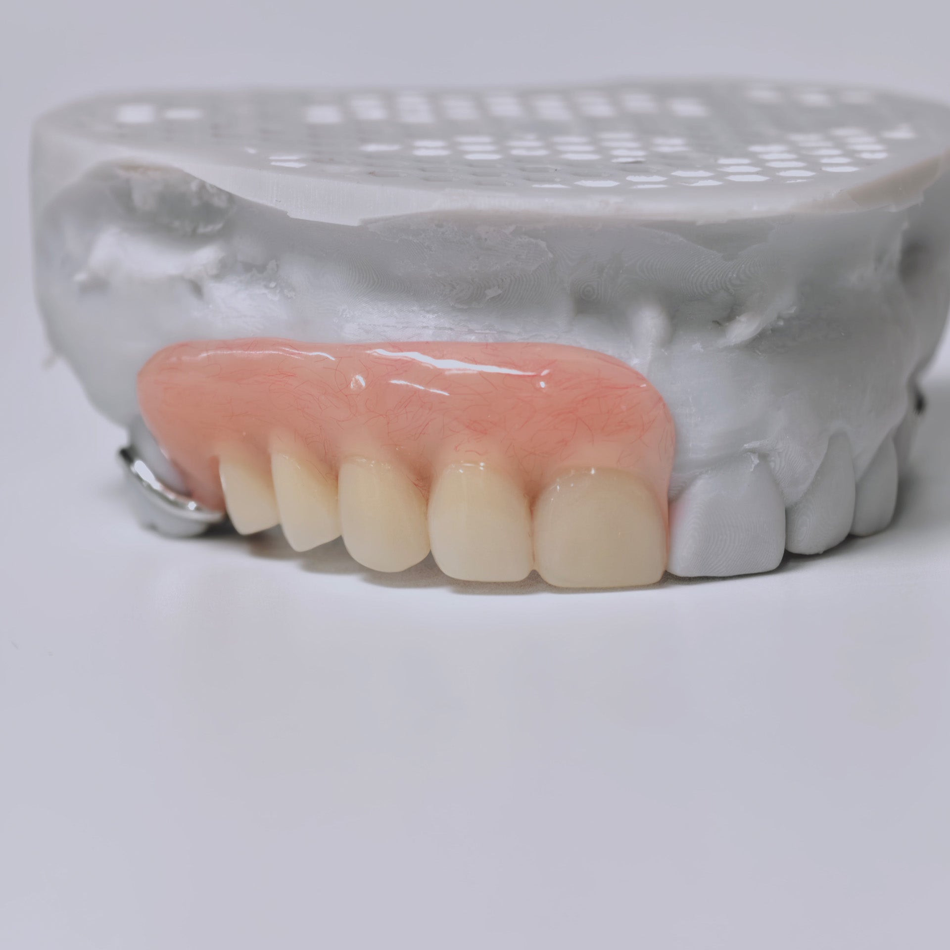 Cobalt Chrome Framework Denture Metal Framework With Acrylic Denture