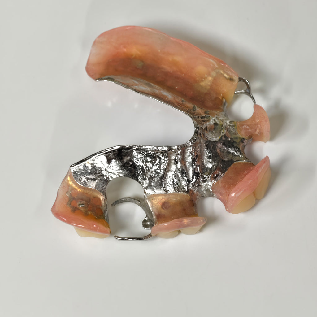Cobalt Chrome Framework Denture Metal Framework With Acrylic Denture