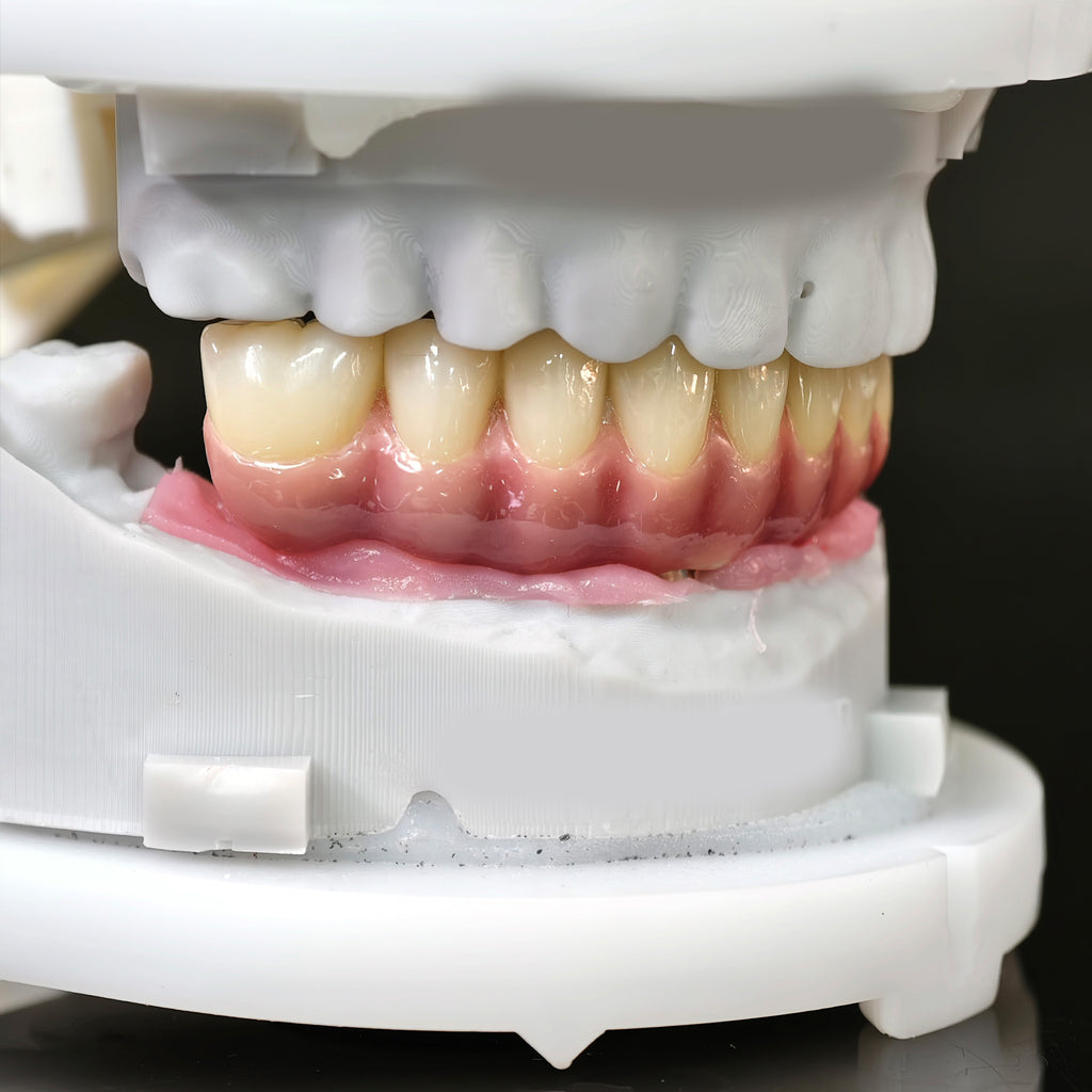 Enhanced Zirconia Crown Malo Bridge