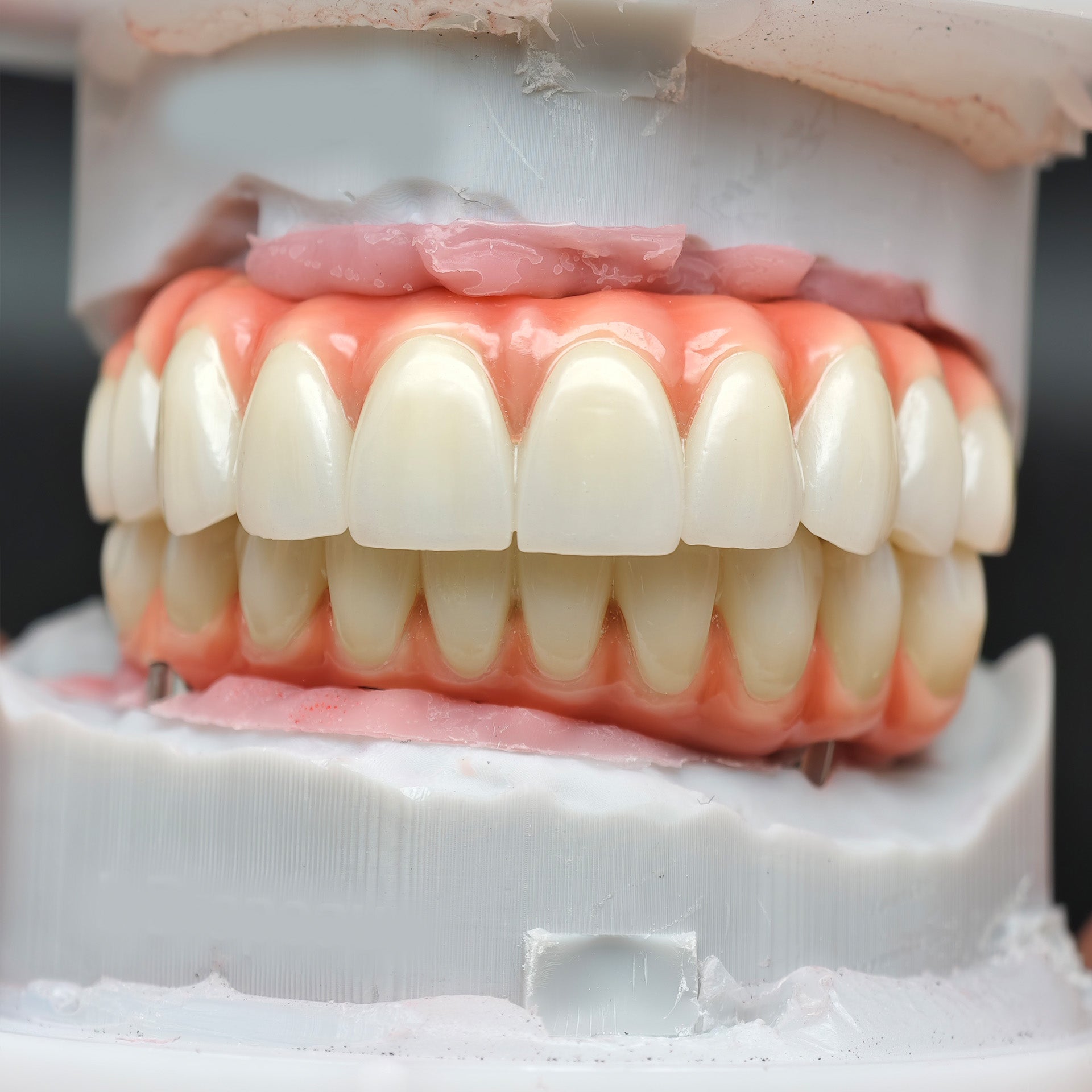 Enhanced Zirconia Crown Malo Bridge