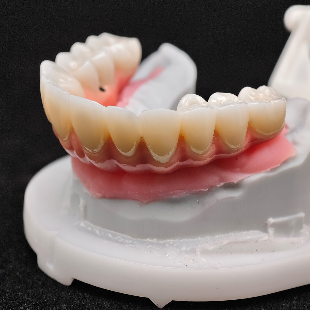 Enhanced Zirconia Crown Malo Bridge