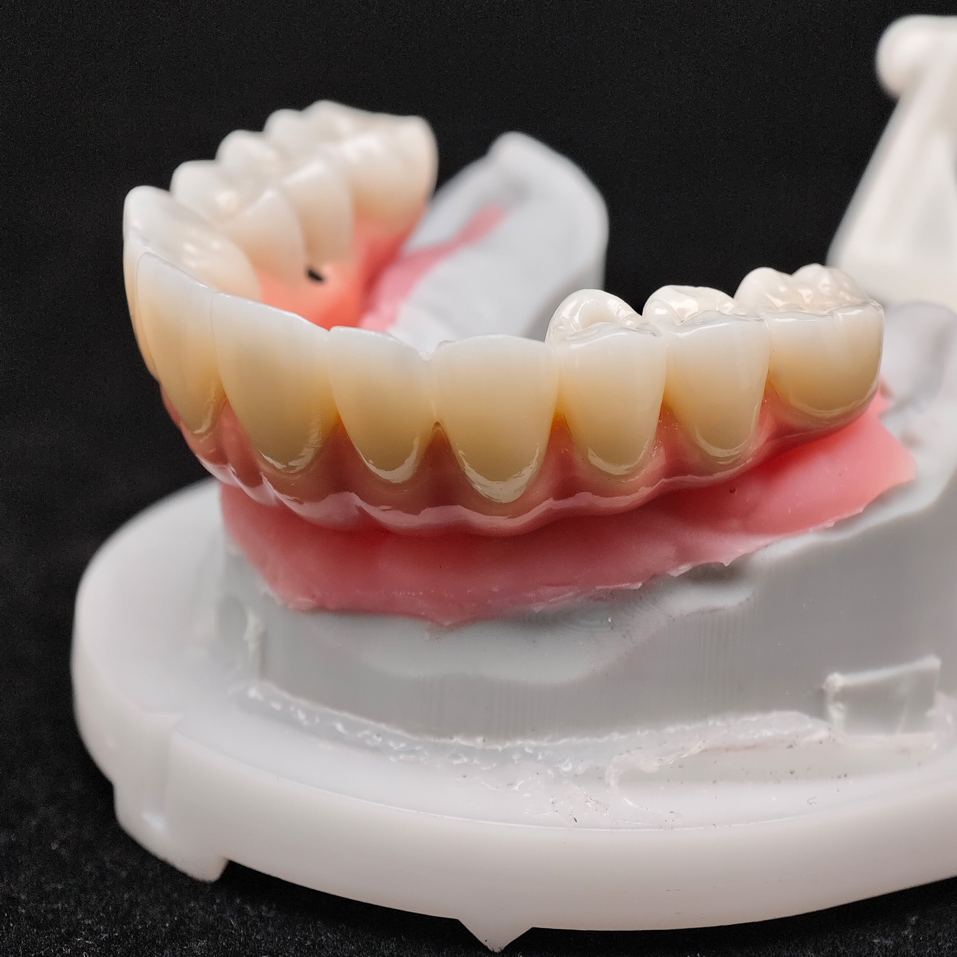 Enhanced Zirconia Crown Malo Bridge
