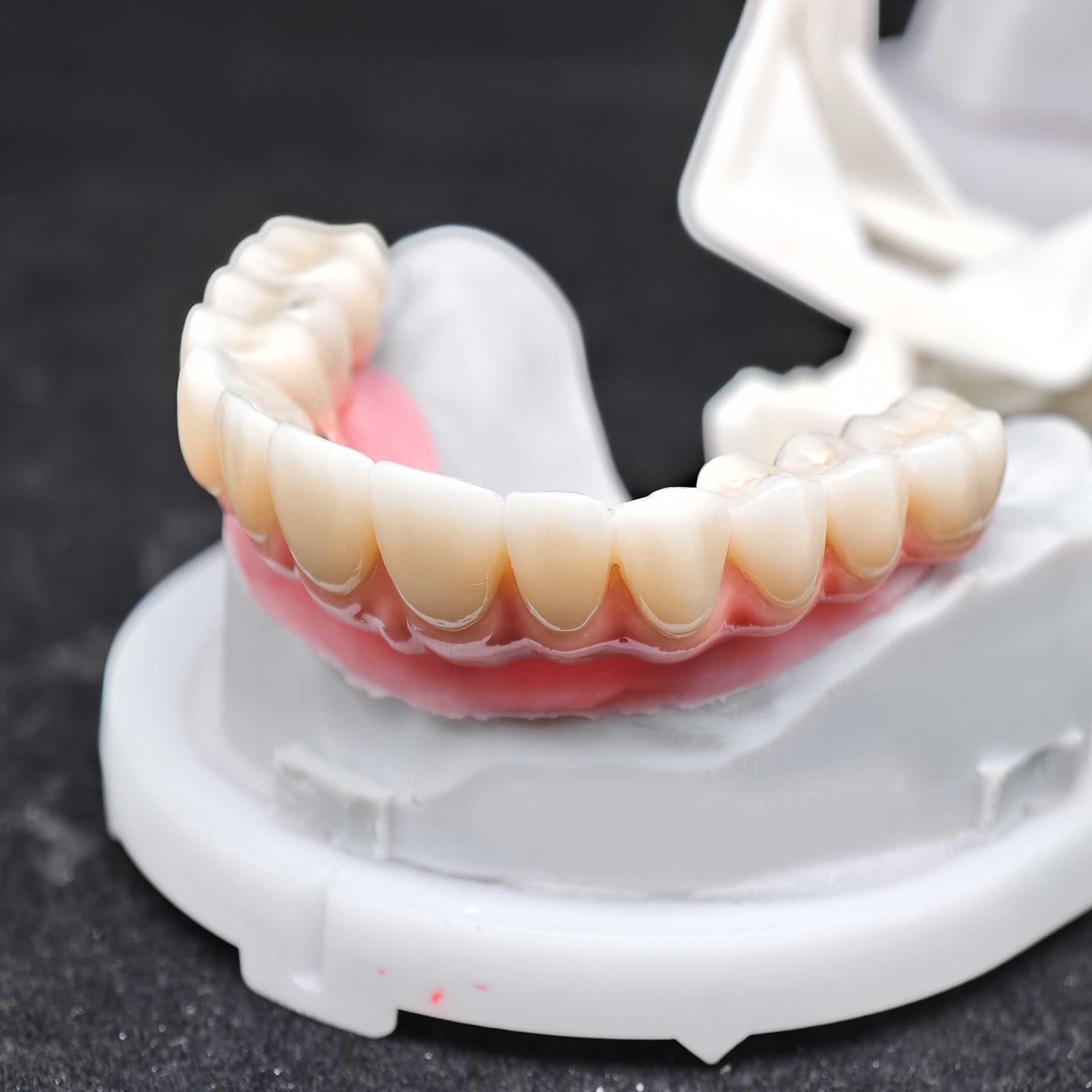 Enhanced Zirconia Crown Malo Bridge