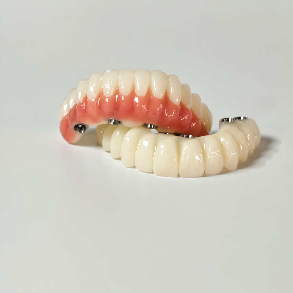 Full-Arch PMMA Bridge With Ti-Base Screw Retained