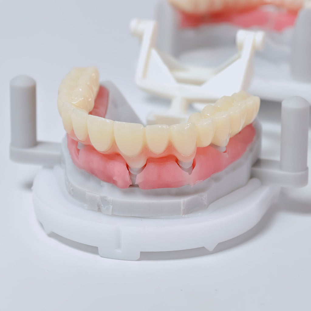 Full-Arch Zirconia Bridge And PMMA Bridge With Cement Retained