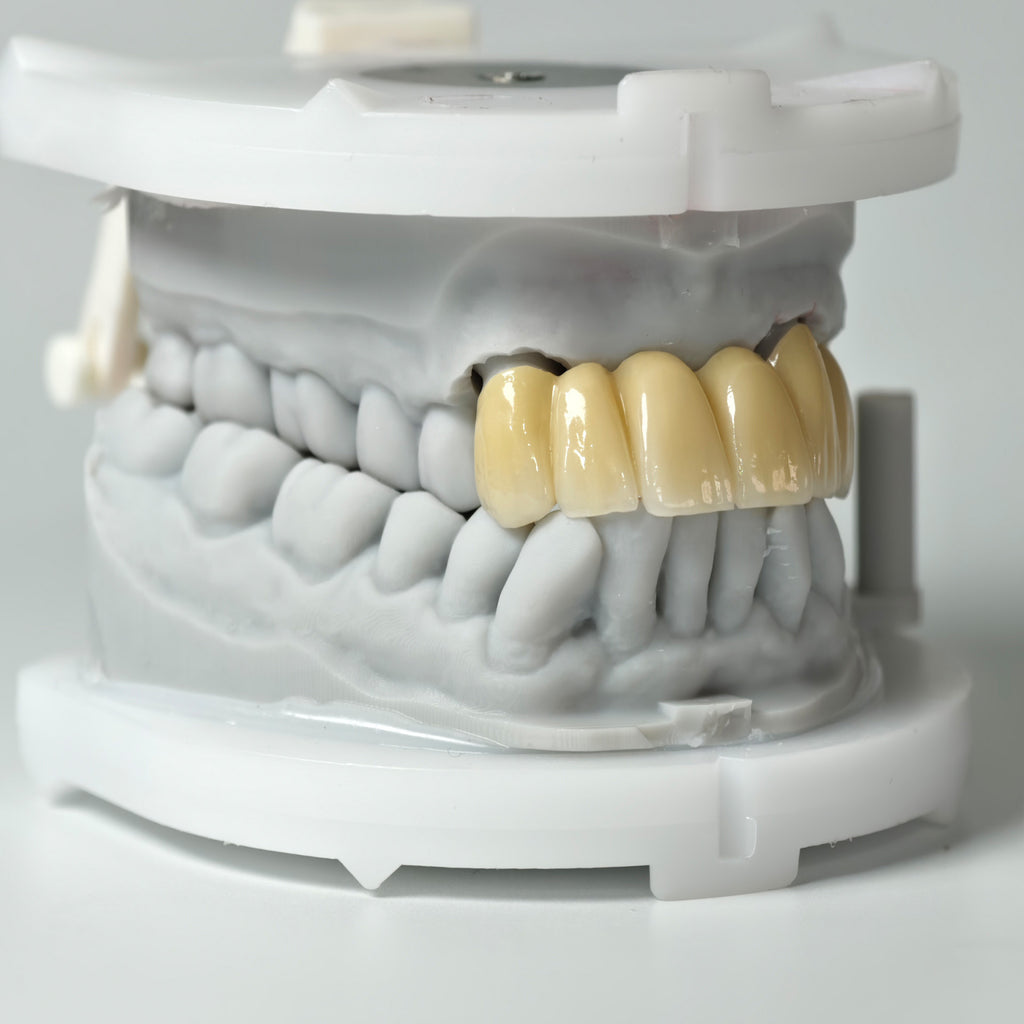 High - Strength Zirconia Bridge