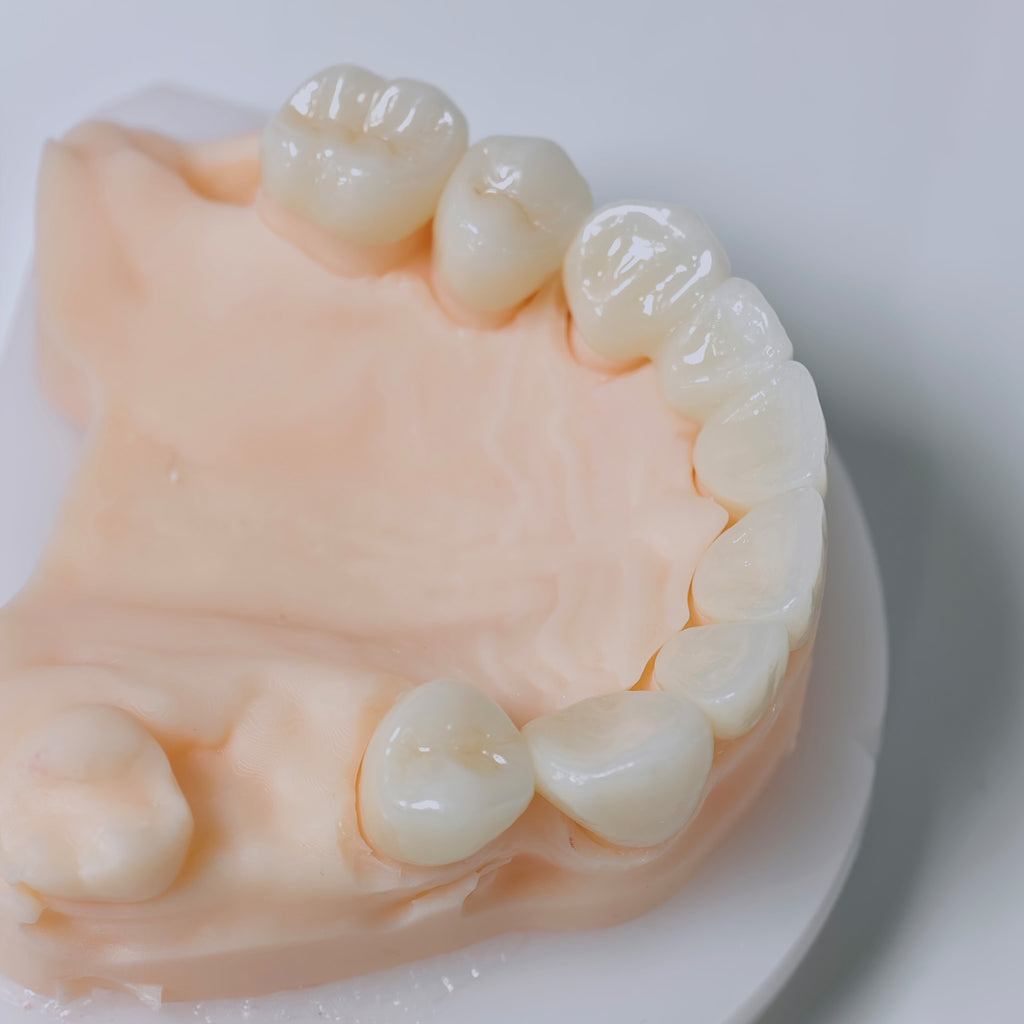 High - Strength Zirconia Bridge And Crown