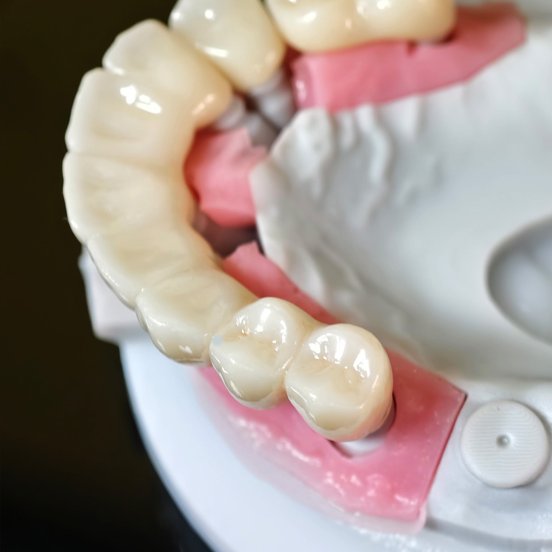 High - Strength Zirconia Crowns And Bridge