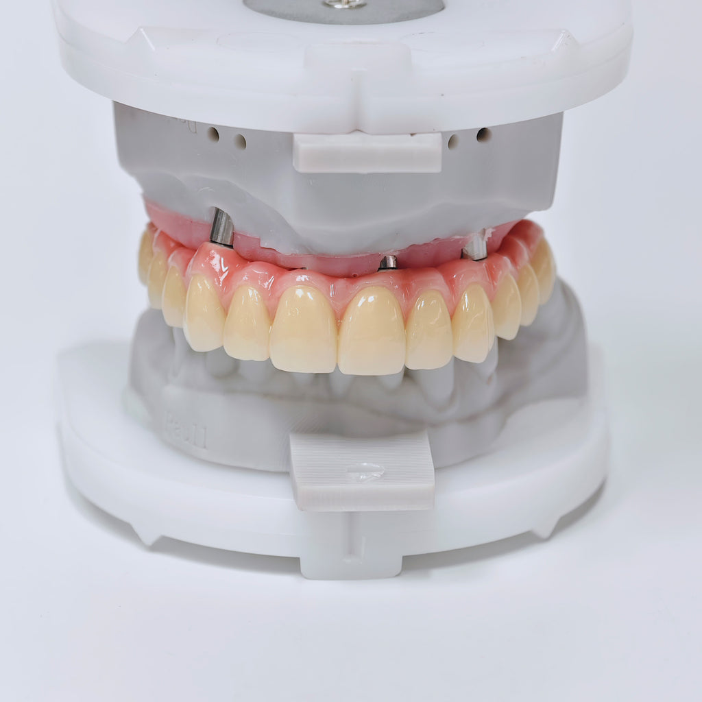 Malo Bridge With Screw-Retained
