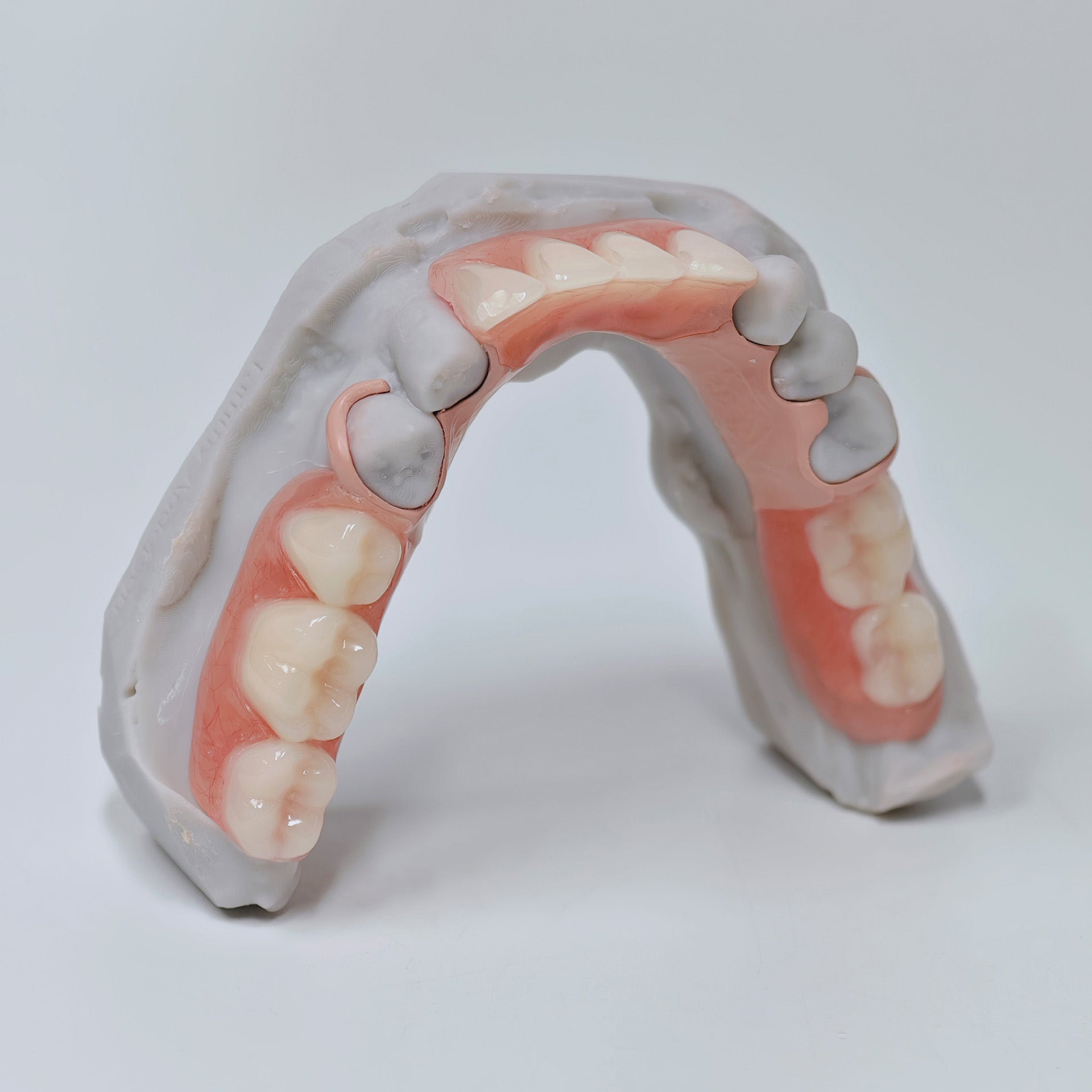 PEEK Framework Denture Metal Framework With Acrylic Denture