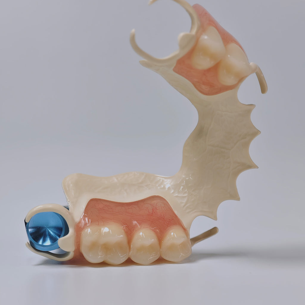 PEEK Framework Denture Metal Framework With Acrylic Denture