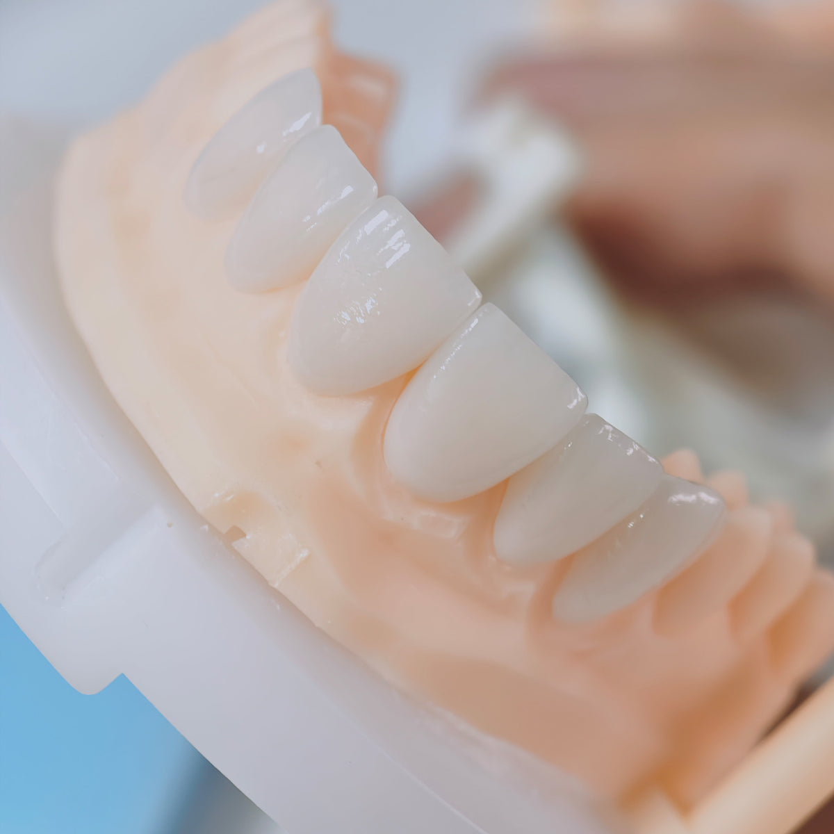 PFZ Porcelain Fused Zirconia Aidite Zirconia