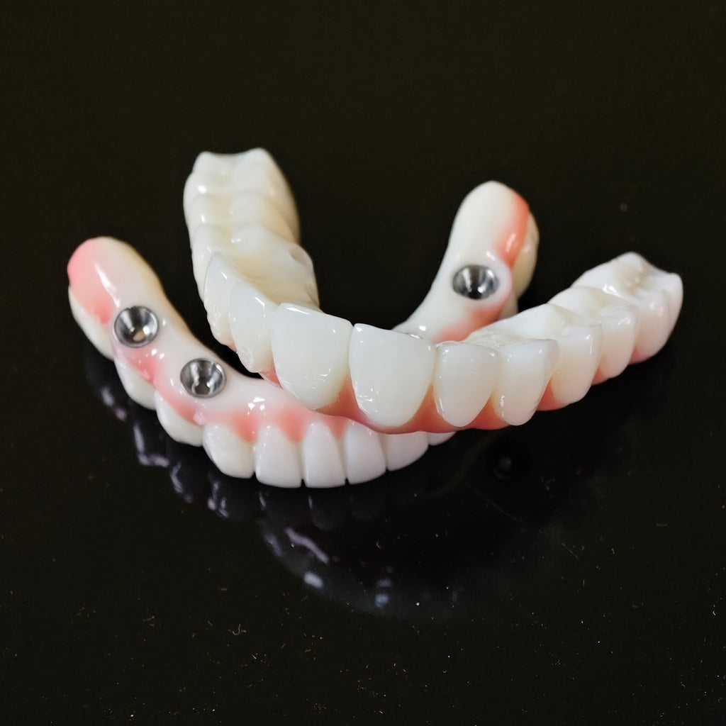 PMMA Bridge With Ti-Base Screw Retained Trying For Full Arch Restoration