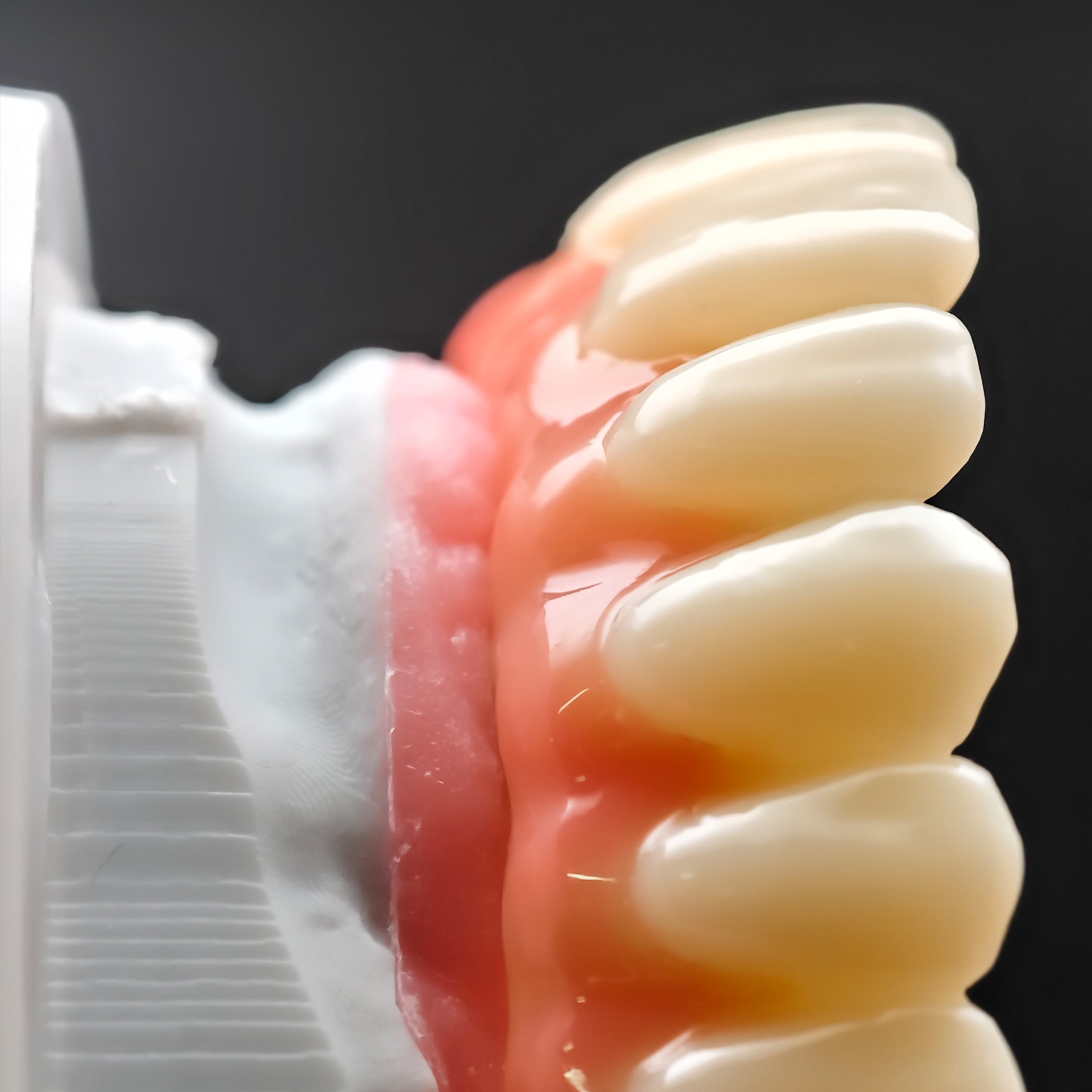 PMMA Bridge With Ti-Base Screw Retained Trying For Full Arch Restoration
