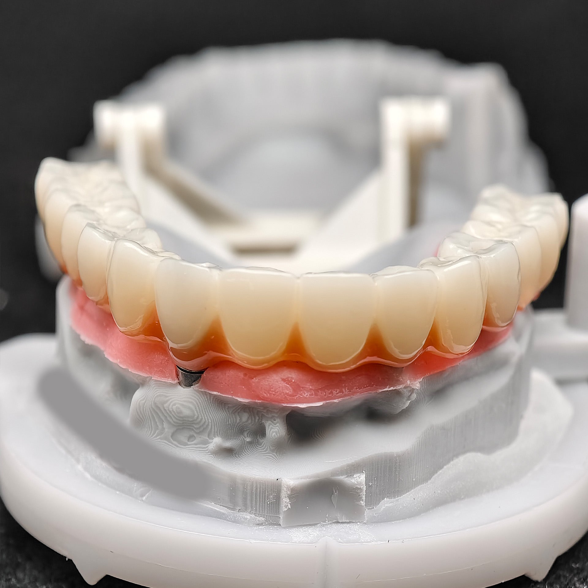 PMMA Bridge With Ti-Base Screw Retained Trying For Full Arch Restoration