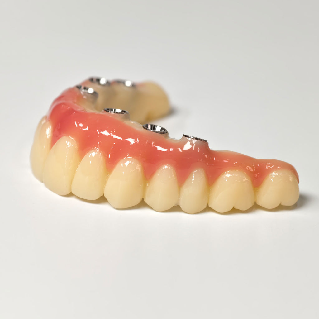 PMMA Bridge With Screw Retained