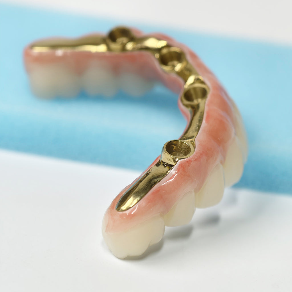 Ti-Bar Titanium Nitride Metal Frame With Zirconia Bridge For Full Arch Restoration
