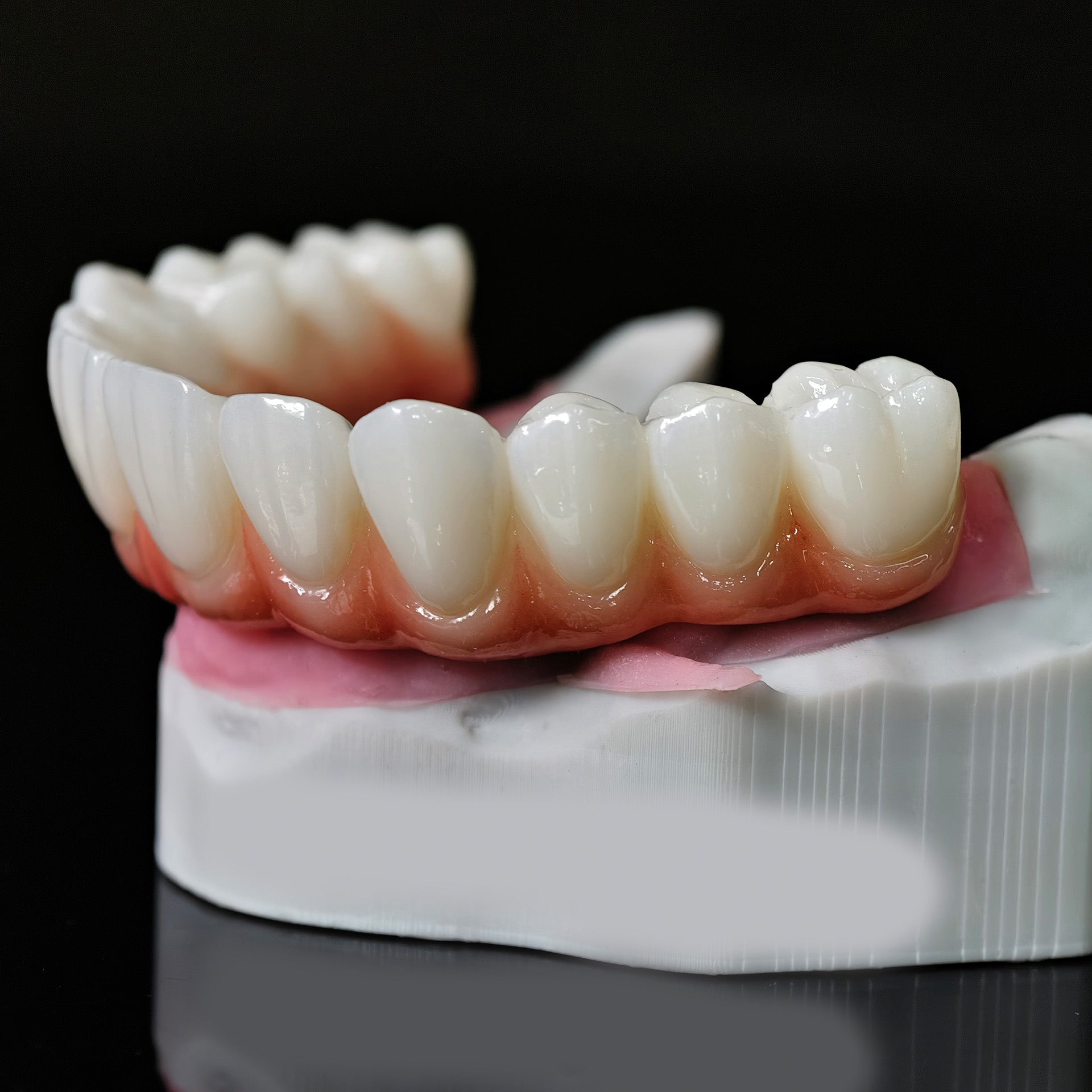 Ti-Bar Titanium Nitride Metal Frame With Zirconia Bridge For Full Arch Restoration