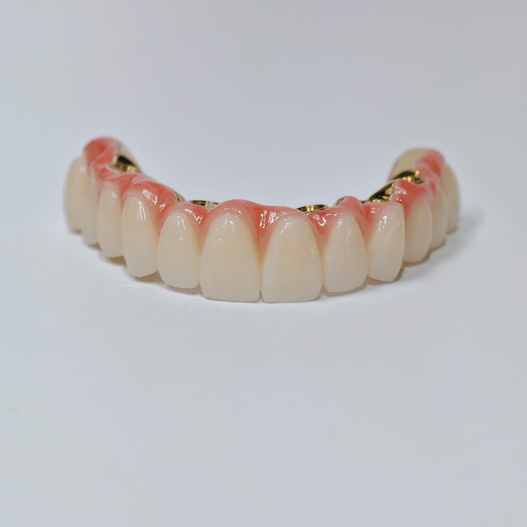 Ti-Bar Titanium Nitride Metal Frame With Zirconia Bridge For Full Arch Restoration