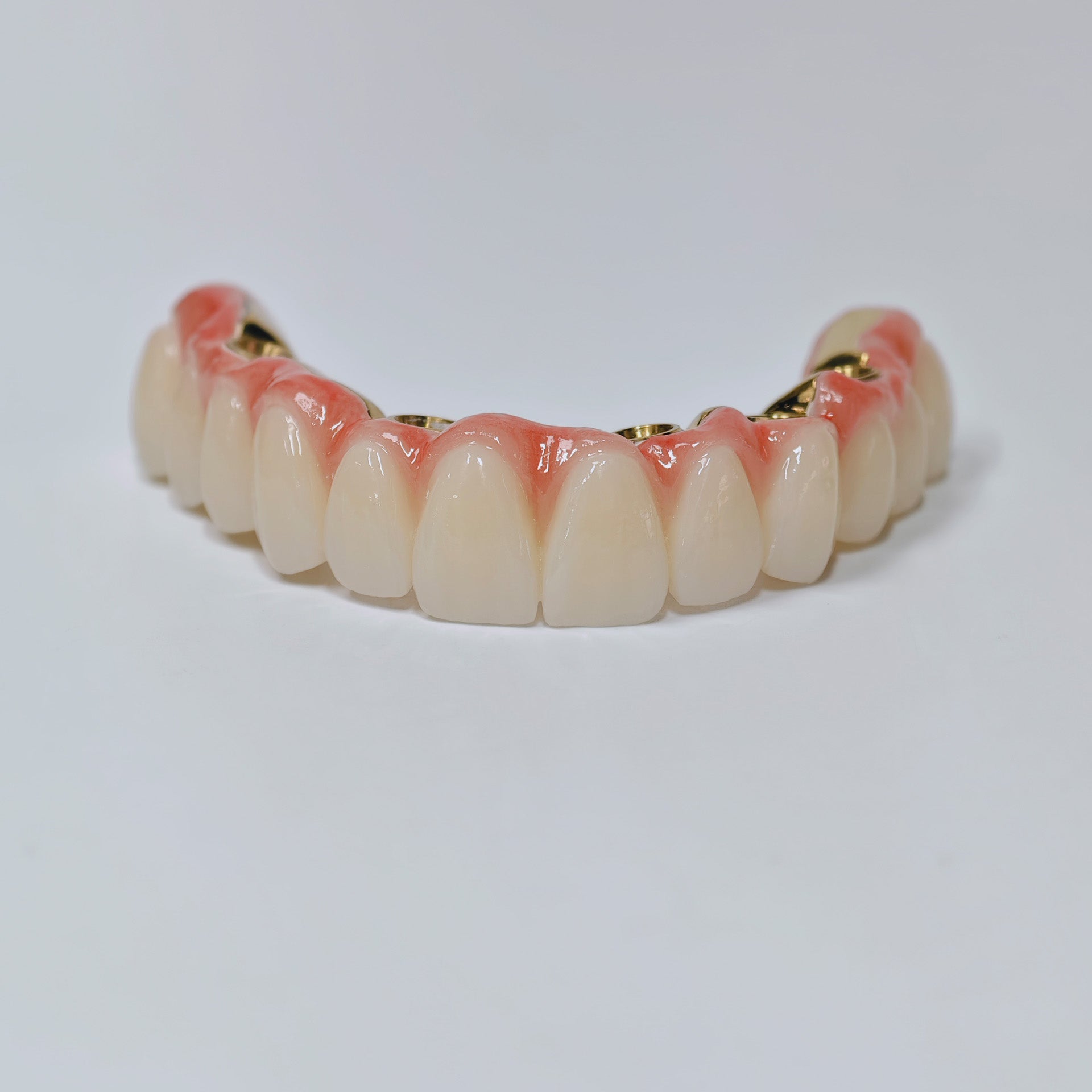 Ti-Bar Titanium Nitride Metal Frame With Zirconia Bridge For Full Arch Restoration