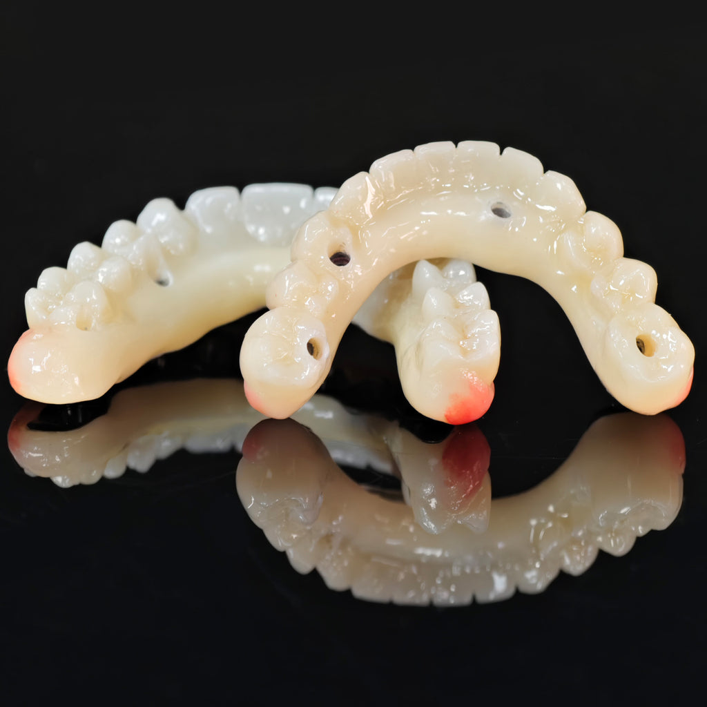 Ti-Bar Titanium Nitride Metal Frame With Zirconia Bridge For Full Arch Restoration