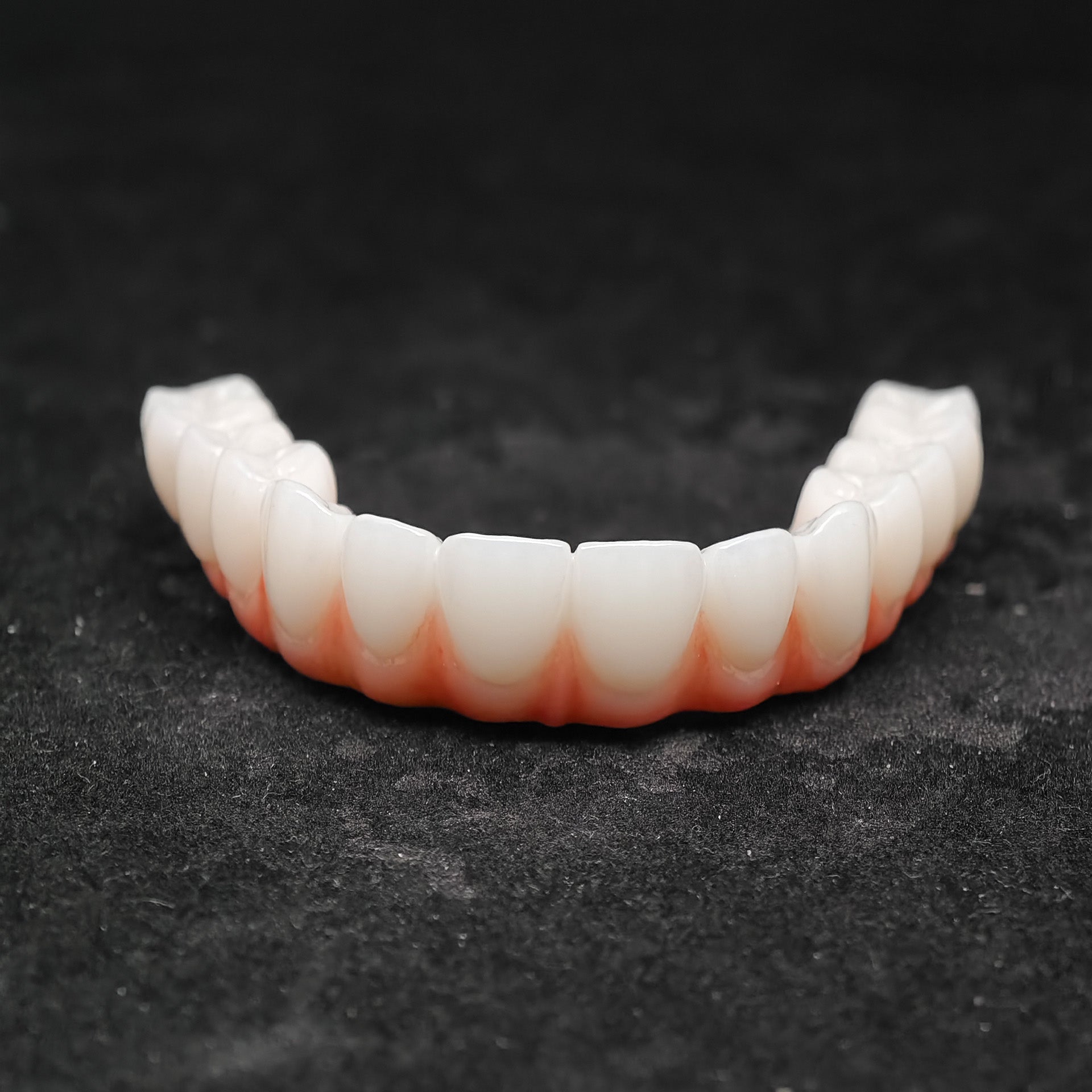 Ti-Bar Titanium Nitride Metal Frame With Zirconia Bridge For Full Arch Restoration