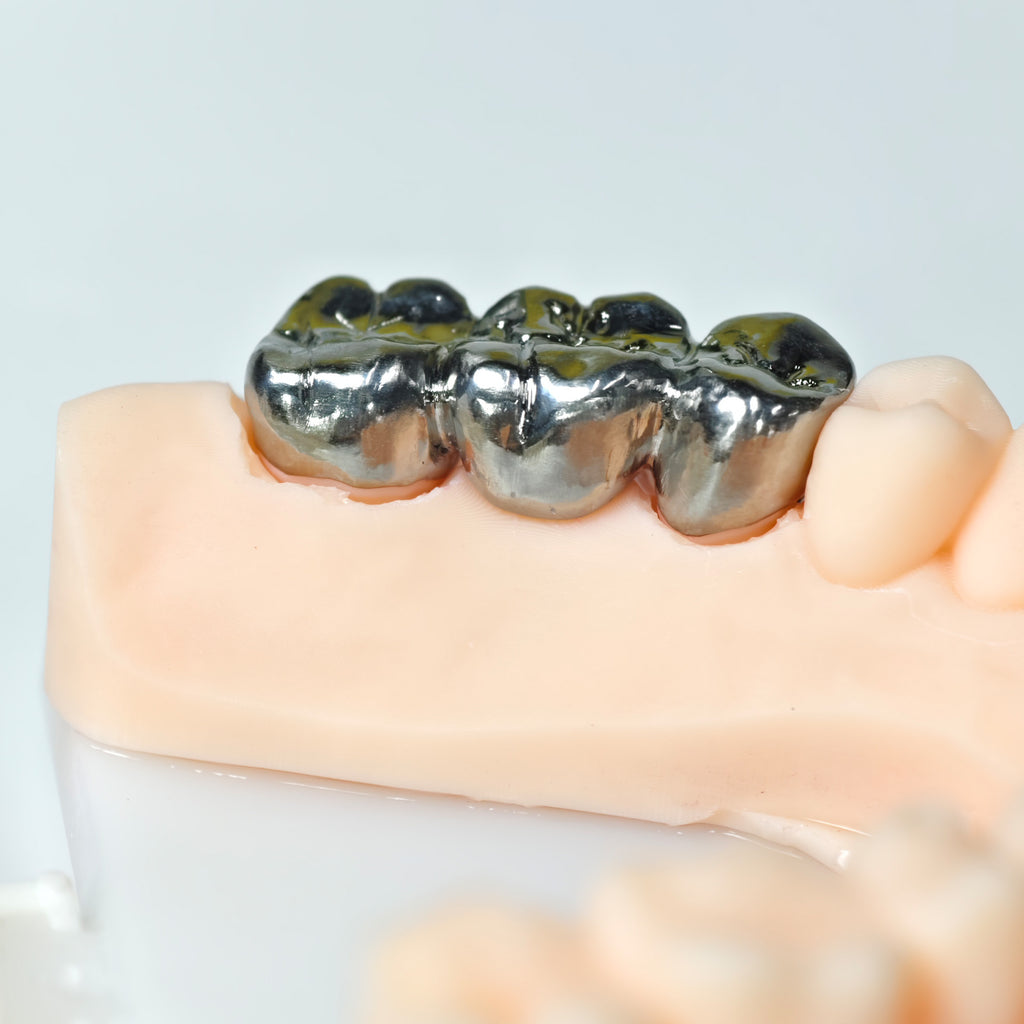 Titanium Crown With Cement Retained