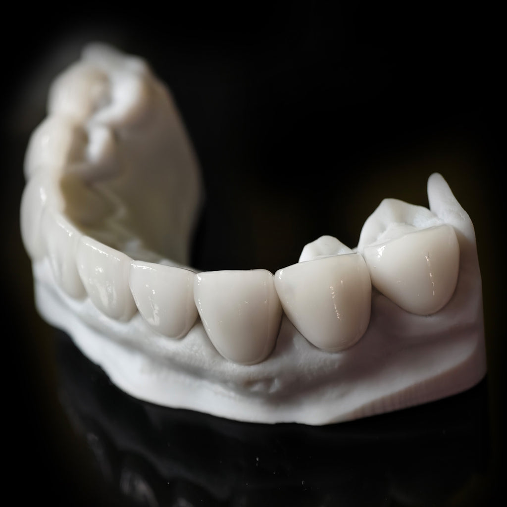Ultra-Thin Emax Veneer. High Transparency/Translucent, Natural Shade