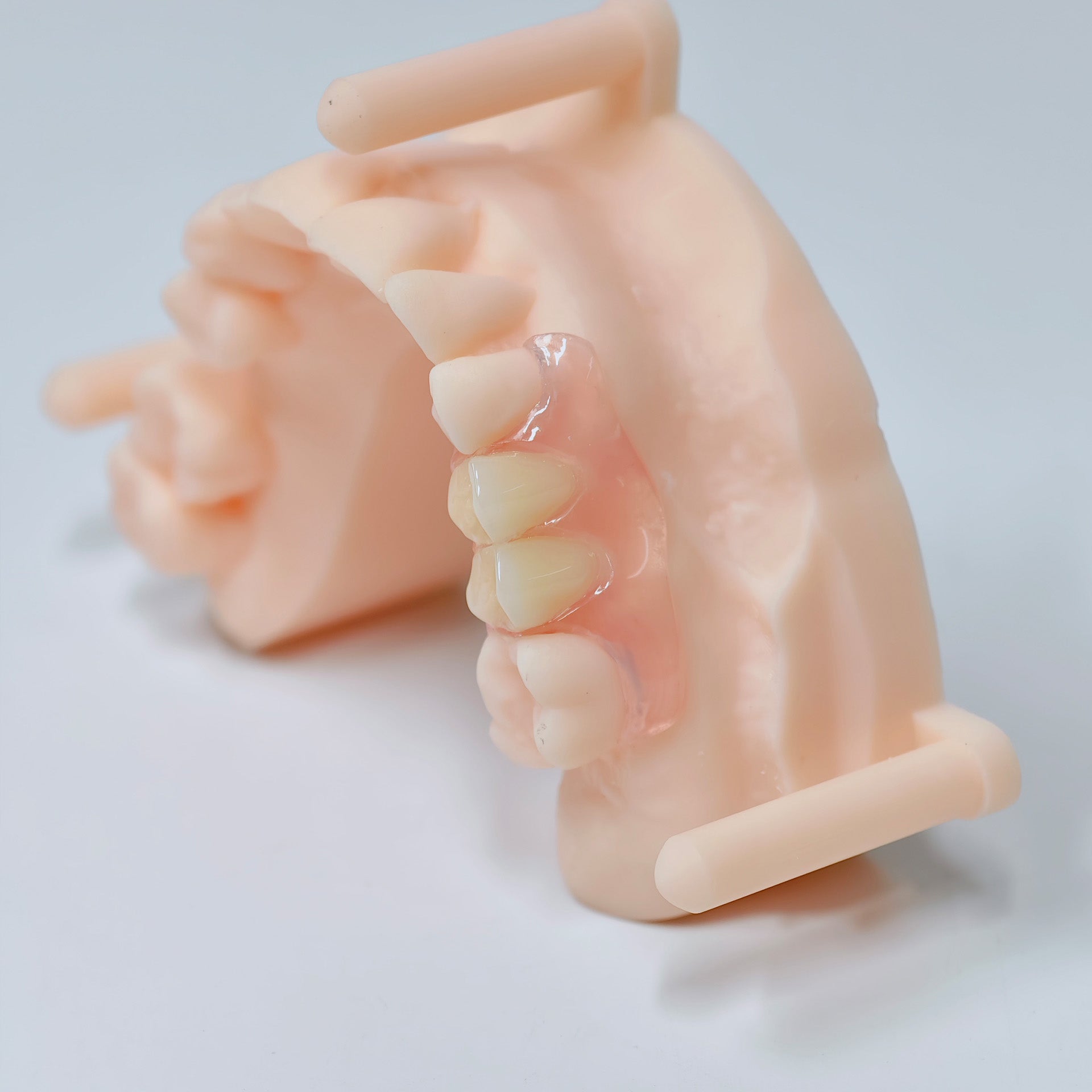 Valplast Denture Beautiful And Elastic Flexible Partial Natural Appearance